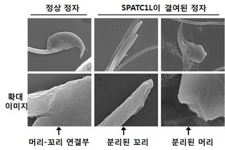 ▲ 정상 정자와 SPATC1L이 결여된 비정상 정자를 비교한 모습. 주사전자현미경(scanning electron microscopy)으로 관찰했다. [한국연구재단 제공=연합뉴스]