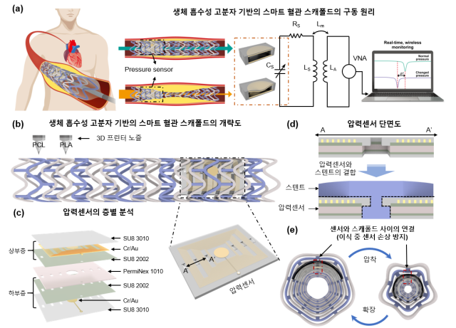3D 프린터를 이용한 SH-BVS 제작 및 혈관 내 실시간 모니터링을 위한 LC 무선 압력 센서와의 통합 개략도. 한국생산기술연구원 제공